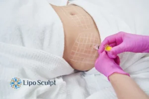 Are The Results From Aqualyx Permanent? 1 Do you want to know how long Aqualyx Rickmansworth results last?