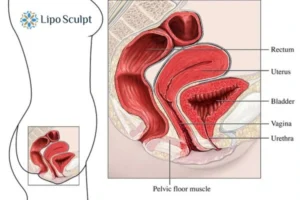 Treatment For A Leaky Bladder 2 How EM Chair treatment Rickmansworth can help Leaky bladder issues. Read more now!