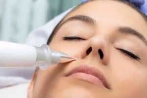 Best Actinic Keratoses Removal 3 Actinic keratoses Rickmansworth solutions - book in today!
